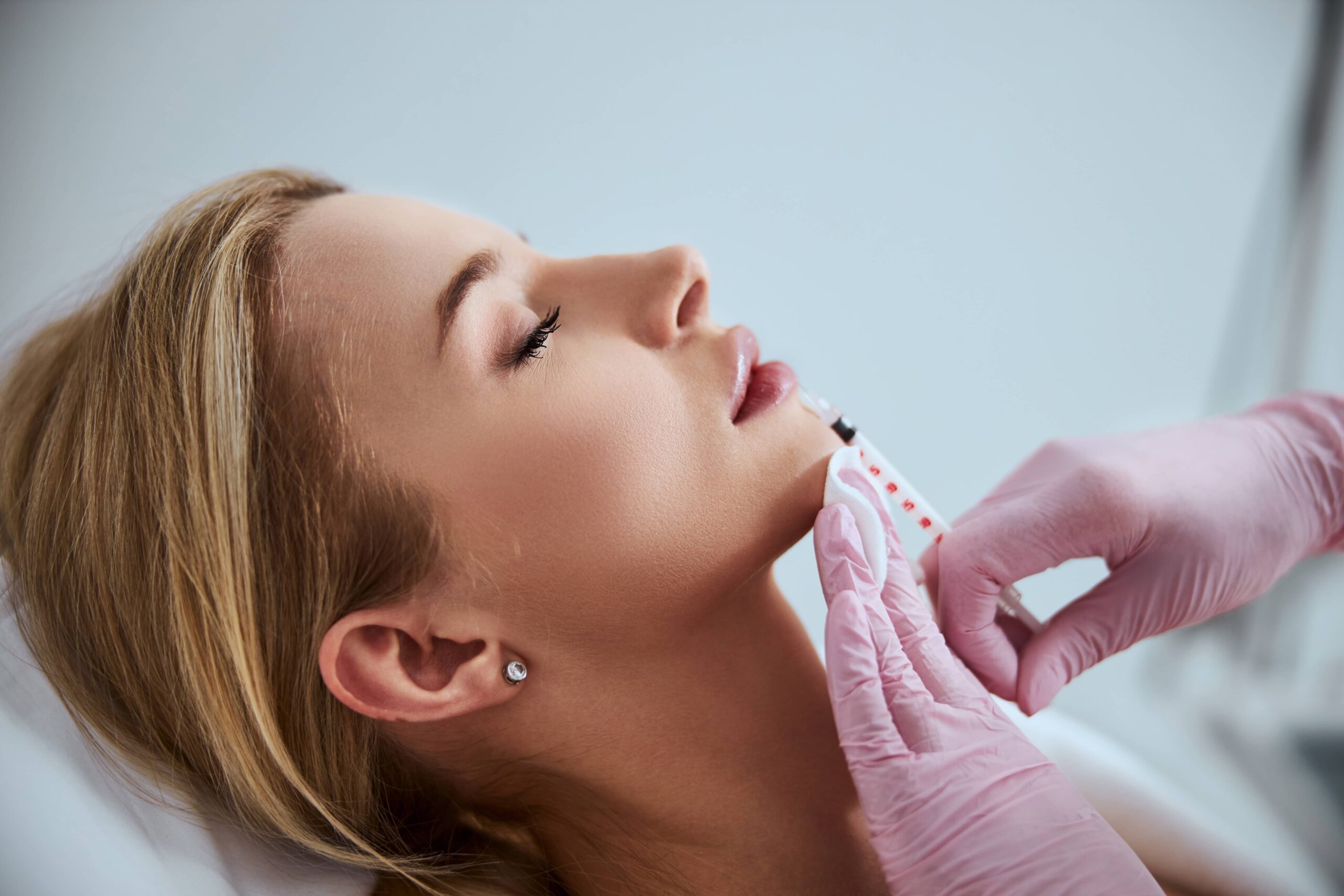 Dermal Fillers