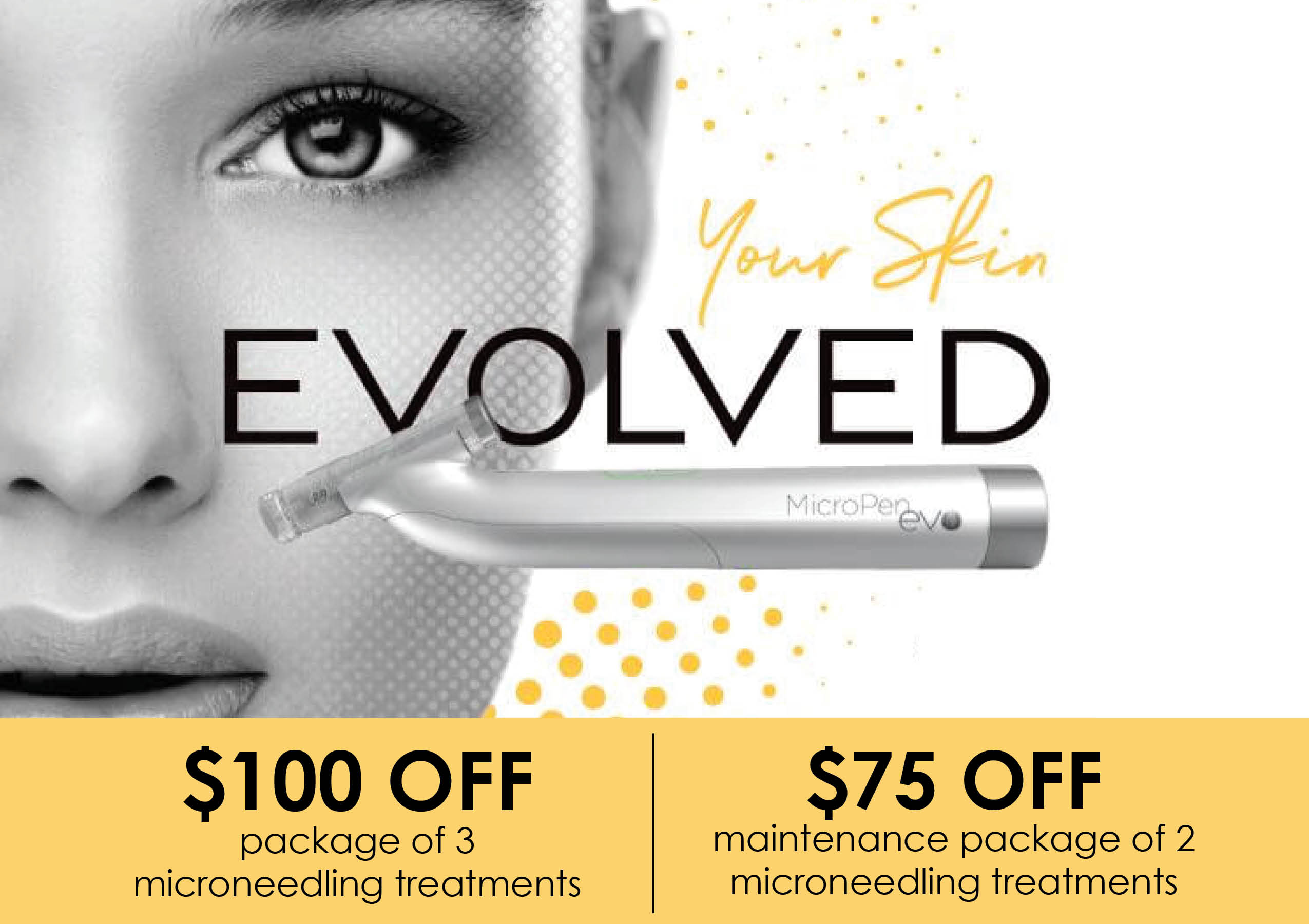 Microneedling Promo June 2024 NEWS About Flexile Classic